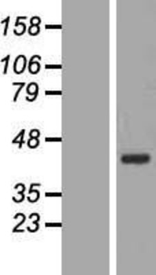 Western Blot: BRX1 Overexpression Lysate (Adult Normal) [NBL1-08062] Left-Empty vector transfected control cell lysate (HEK293 cell lysate); Right -Over-expression Lysate for BRX1.