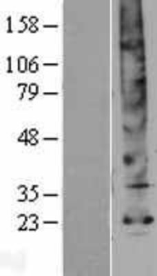 Western Blot: Aquaporin-5 Overexpression Lysate (Adult Normal) [NBP2-04201] Left-Empty vector transfected control cell lysate (HEK293 cell lysate); Right -Over-expression Lysate for Aquaporin-5.