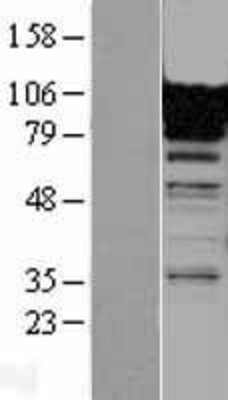 Western Blot: FCN3 Overexpression Lysate (Adult Normal) [NBP2-04434] Left-Empty vector transfected control cell lysate (HEK293 cell lysate); Right -Over-expression Lysate for FCN3.