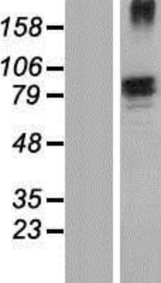 Western Blot: Fibronectin Overexpression Lysate (Adult Normal) [NBP2-04486] Left-Empty vector transfected control cell lysate (HEK293 cell lysate); Right -Over-expression Lysate for Fibronectin.