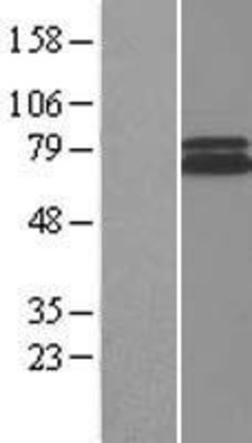 Western Blot: Rad1 Overexpression Lysate (Adult Normal) [NBP2-04415] Left-Empty vector transfected control cell lysate (HEK293 cell lysate); Right -Over-expression Lysate for Rad1.