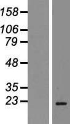 Western Blot: Stathmin 1 Overexpression Lysate (Adult Normal) [NBP2-04564] Left-Empty vector transfected control cell lysate (HEK293 cell lysate); Right -Over-expression Lysate for Stathmin 1.