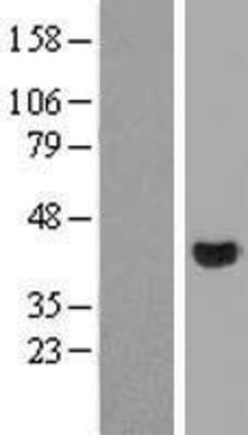 Western Blot: MBNL2 Overexpression Lysate (Adult Normal) [NBP2-04507] Left-Empty vector transfected control cell lysate (HEK293 cell lysate); Right -Over-expression Lysate for MBNL2.