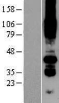 Western Blot: PORCN Overexpression Lysate (Adult Normal) [NBP2-04454] Left-Empty vector transfected control cell lysate (HEK293 cell lysate); Right -Over-expression Lysate for PORCN.