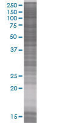 IL7R transfected lysate.