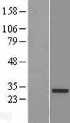 Western Blot: PAQR6 Overexpression Lysate (Adult Normal) [NBP2-04736] Left-Empty vector transfected control cell lysate (HEK293 cell lysate); Right -Over-expression Lysate for PAQR6.