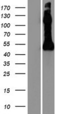 Western Blot: NPTX2 Overexpression Lysate (Adult Normal) [NBP2-08106] Left-Empty vector transfected control cell lysate (HEK293 cell lysate); Right -Over-expression Lysate for NPTX2.