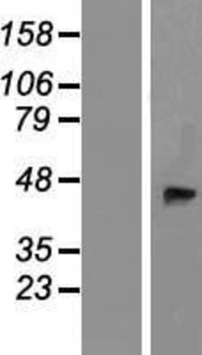 Western Blot: B4GALT2 Overexpression Lysate (Adult Normal) [NBP2-07956] Left-Empty vector transfected control cell lysate (HEK293 cell lysate); Right -Over-expression Lysate for B4GALT2.
