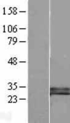 Western Blot: DKK1 Overexpression Lysate (Adult Normal) [NBL1-09901] Left-Empty vector transfected control cell lysate (HEK293 cell lysate); Right -Over-expression Lysate for DKK1.
