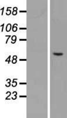 Western Blot: Carbohydrate sulfotransferase 3 Overexpression Lysate (Adult Normal) [NBL1-09195] Left-Empty vector transfected control cell lysate (HEK293 cell lysate); Right -Over-expression Lysate for Carbohydrate sulfotransferase 3.