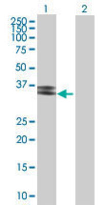 Lane 1: PPT2 transfected lysate (33.33 KDa) Lane 2: Non-transfected lysate.
