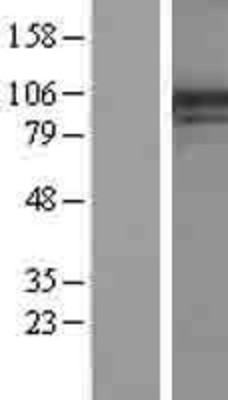 Western Blot: PIK4CA Overexpression Lysate (Adult Normal) [NBL1-14382] Left-Empty vector transfected control cell lysate (HEK293 cell lysate); Right -Over-expression Lysate for PIK4CA.