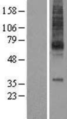 Western Blot: MCHR Overexpression Lysate (Adult Normal) [NBL1-12947] Left-Empty vector transfected control cell lysate (HEK293 cell lysate); Right -Over-expression Lysate for MCHR.