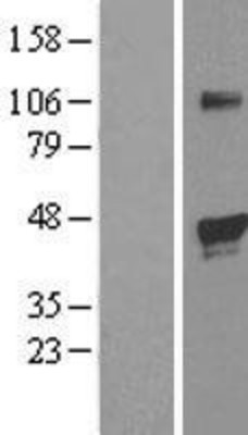 Western Blot: PHD1/HIF Prolyl Hydroxylase 1 Overexpression Lysate (Adult Normal) [NBL1-10154] Left-Empty vector transfected control cell lysate (HEK293 cell lysate); Right -Over-expression Lysate for HIF Prolyl Hydroxylase 1.