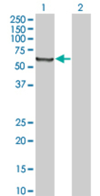 Lane 1: TGM2 transfected lysate (61.7 KDa) Lane 2: Non-transfected lysate.