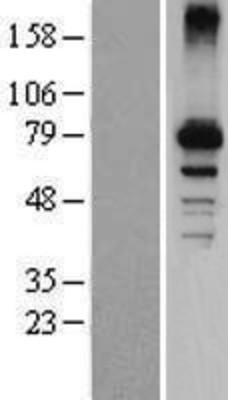 Western Blot: CYP7B1 Overexpression Lysate (Adult Normal) [NBP2-07820] Left-Empty vector transfected control cell lysate (HEK293 cell lysate); Right -Over-expression Lysate for CYP7B1.