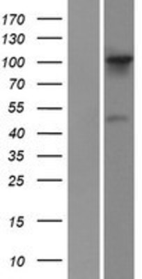 Western Blot: FGD1 Overexpression Lysate (Adult Normal) [NBP2-07871] Left-Empty vector transfected control cell lysate (HEK293 cell lysate); Right -Over-expression Lysate for FGD1.