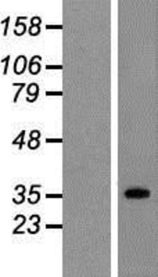 Western Blot: SUCLG1 Overexpression Lysate (Adult Normal) [NBP2-07943] Left-Empty vector transfected control cell lysate (HEK293 cell lysate); Right -Over-expression Lysate for SUCLG1.
