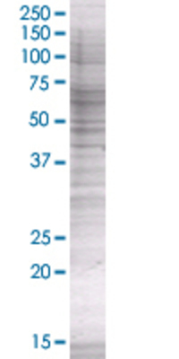 TGM2 transfected lysate.