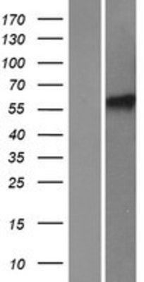 Western Blot: HIRIP3 Overexpression Lysate (Adult Normal) [NBP2-07975] Left-Empty vector transfected control cell lysate (HEK293 cell lysate); Right -Over-expression Lysate for HIRIP3.