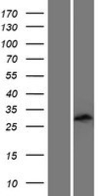 Western Blot: Dlx6 Overexpression Lysate (Adult Normal) [NBP2-07772] Left-Empty vector transfected control cell lysate (HEK293 cell lysate); Right -Over-expression Lysate for Dlx6.