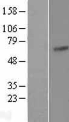 Western Blot: LPP Overexpression Lysate (Adult Normal) [NBP2-07731] Left-Empty vector transfected control cell lysate (HEK293 cell lysate); Right -Over-expression Lysate for LPP.