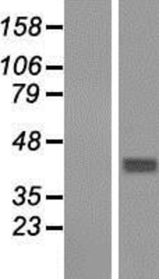 Western Blot: GNA14 Overexpression Lysate (Adult Normal) [NBP2-07884] Left-Empty vector transfected control cell lysate (HEK293 cell lysate); Right -Over-expression Lysate for GNA14.