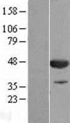 Western Blot: CNPase Overexpression Lysate (Adult Normal) [NBL1-09322] Left-Empty vector transfected control cell lysate (HEK293 cell lysate); Right -Over-expression Lysate for CNPase.