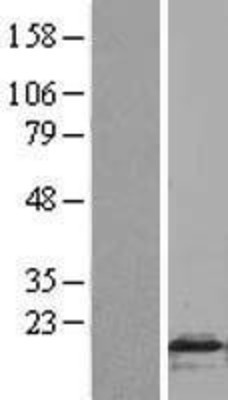 Western Blot: FLAP Overexpression Lysate (Adult Normal) [NBL1-07484] Left-Empty vector transfected control cell lysate (HEK293 cell lysate); Right -Over-expression Lysate for FLAP.