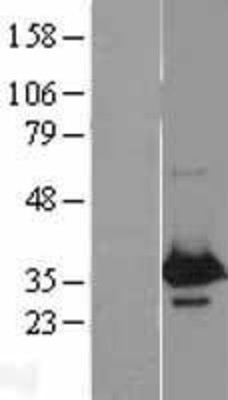 Western Blot: WBP2 Overexpression Lysate (Adult Normal) [NBL1-17781] Left-Empty vector transfected control cell lysate (HEK293 cell lysate); Right -Over-expression Lysate for WBP2.