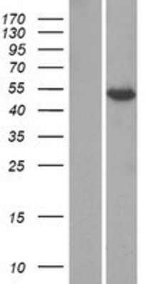 Western Blot: KCTD8 Overexpression Lysate (Adult Normal) [NBP2-04728] Left-Empty vector transfected control cell lysate (HEK293 cell lysate); Right -Over-expression Lysate for KCTD8.