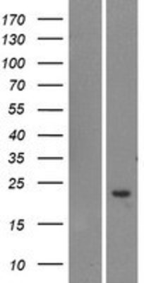 Western Blot: TOMM20L Overexpression Lysate (Adult Normal) [NBP2-04495] Left-Empty vector transfected control cell lysate (HEK293 cell lysate); Right -Over-expression Lysate for TOMM20L.