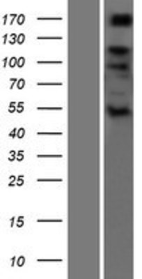 Western Blot: ADAMTS6 Overexpression Lysate (Adult Normal) [NBP2-04759] Left-Empty vector transfected control cell lysate (HEK293 cell lysate); Right -Over-expression Lysate for ADAMTS6.