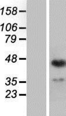 Western Blot: ING1 Overexpression Lysate (Adult Normal) [NBP2-04707] Left-Empty vector transfected control cell lysate (HEK293 cell lysate); Right -Over-expression Lysate for ING1.