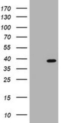 Western Blot: PCNA Overexpression Lysate (Adult Normal) [NBP2-04828] Left-Empty vector transfected control cell lysate (HEK293 cell lysate); Right -Over-expression Lysate for PCNA.