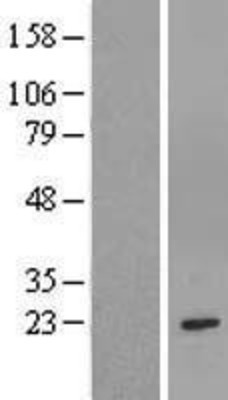 Western Blot: GSTM1 Overexpression Lysate (Adult Normal) [NBL1-11372] Left-Empty vector transfected control cell lysate (HEK293 cell lysate); Right -Over-expression Lysate for GSTM1.