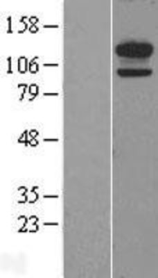 Western Blot: H Cadherin Overexpression Lysate (Adult Normal) [NBL1-09026] Left-Empty vector transfected control cell lysate (HEK293 cell lysate); Right -Over-expression Lysate for H Cadherin.