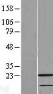 Western Blot: RAIDD Overexpression Lysate (Adult Normal) [NBL1-09459] Left-Empty vector transfected control cell lysate (HEK293 cell lysate); Right -Over-expression Lysate for RAIDD.