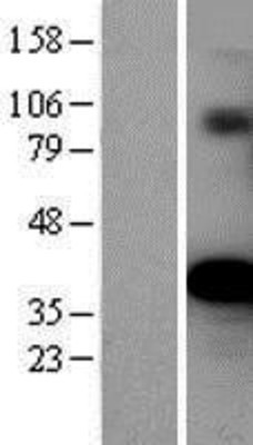 Western Blot: Ornithine Carbamoyltransferase Overexpression Lysate (Adult Normal) [NBP2-04161] Left-Empty vector transfected control cell lysate (HEK293 cell lysate); Right -Over-expression Lysate for Ornithine Carbamoyltransferase.