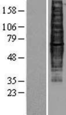 Western Blot: CCR9 Overexpression Lysate (Adult Normal) [NBP2-04314] Left-Empty vector transfected control cell lysate (HEK293 cell lysate); Right -Over-expression Lysate for CCR9.