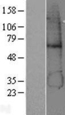 Western Blot: alcohol dehydrogenase 5 Overexpression Lysate (Adult Normal) [NBP2-04170] Left-Empty vector transfected control cell lysate (HEK293 cell lysate); Right -Over-expression Lysate for alcohol dehydrogenase 5.