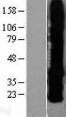 Western Blot: Connexin 26/GJB2 Overexpression Lysate (Adult Normal) [NBP2-04260] Left-Empty vector transfected control cell lysate (HEK293 cell lysate); Right -Over-expression Lysate for Connexin 26/GJB2.