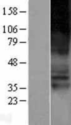 Western Blot: SLC22A4 Overexpression Lysate (Adult Normal) [NBP2-04242] Left-Empty vector transfected control cell lysate (HEK293 cell lysate); Right -Over-expression Lysate for SLC22A4.