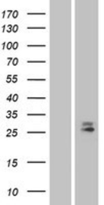 Western Blot: CD302 Overexpression Lysate (Adult Normal) [NBP2-04346] Left-Empty vector transfected control cell lysate (HEK293 cell lysate); Right -Over-expression Lysate for CD302.