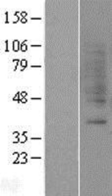 Western Blot: GRPR Overexpression Lysate (Adult Normal) [NBP2-04290] Left-Empty vector transfected control cell lysate (HEK293 cell lysate); Right -Over-expression Lysate for GRPR.