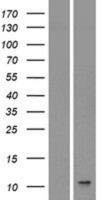 Western Blot: IL8 Overexpression Lysate (Adult Normal) [NBP2-04166] Left-Empty vector transfected control cell lysate (HEK293 cell lysate); Right -Over-expression Lysate for IL8.