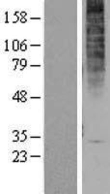 Western Blot: GPR1 Overexpression Lysate (Adult Normal) [NBP2-04283] Left-Empty vector transfected control cell lysate (HEK293 cell lysate); Right -Over-expression Lysate for GPR1.