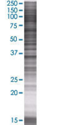 BLVRA transfected lysate.