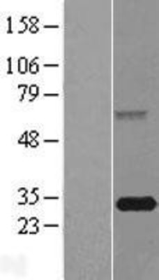 Western Blot: FBXO44 Overexpression Lysate (Adult Normal) [NBP2-04768] Left-Empty vector transfected control cell lysate (HEK293 cell lysate); Right -Over-expression Lysate for FBXO44.