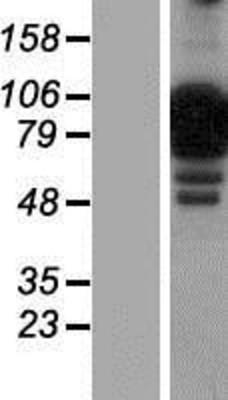 Western Blot: NCKIPSD Overexpression Lysate (Adult Normal) [NBP2-04774] Left-Empty vector transfected control cell lysate (HEK293 cell lysate); Right -Over-expression Lysate for NCKIPSD.